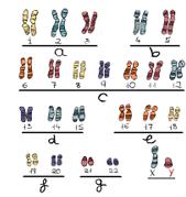 INTRODUCCIÓN 4) Desinapsis total de bivalentes. Es muy infrecuente y afecta a todos los cromosomas. Normalmente se produce fragmentación cromosómica (Templado et al.