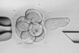 Finalmente, se libera el embrión de la pipeta holding, y se retiran los