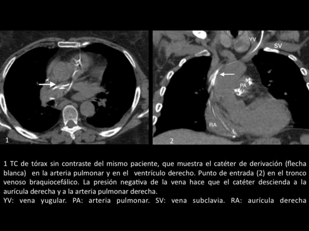 Fig. 6 Referencias: N. ROMERO FLOREZ; Radiología, Hospital universitario Dr.