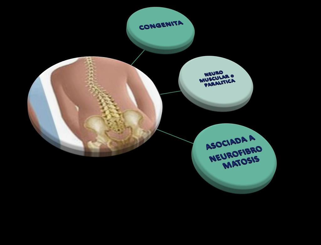 Producida por malformaciones óseas de la columna vertebra. Estas son de tres tipos: 1) defectos de formación.