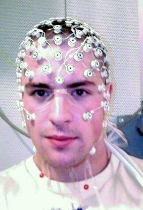 Registro funcional de la actividad eléctrica (I) Electroencefalografía (EEG): Mide las señales eléctricas del cerebro en la superficie del cráneo La detección de ondas