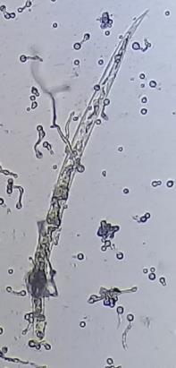 Imagen 17: Larva de Meloidogyne sp.