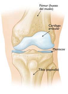osteoartritis. Las radiografías muestran si el daño al cartílago ha reducido el espacio articular que separa los huesos de la rodilla.