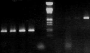 1 2 3 4 5 6 7 8 9 10 1500 pb 850 pb Fig. 6: Electroforesis de los amplificados de la PCR con iniciadores específicos CTX-M-9 INT (Carriles 1-5) y CTX- M-9 EXT (Carriles 7-10) de las muestras de E.