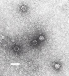 norovirus sapovirus
