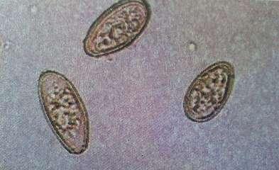 Schistosoma spp.
