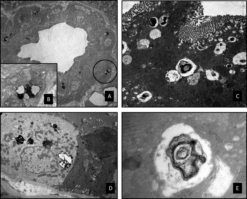 Lesiones histopatológicas vistas por Microscopia Electrónica.