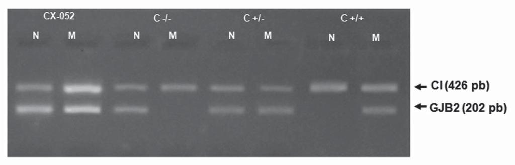 LÓPEZ G. y cols. Figura 1. Metodología de estudio genético para GJB2 y GJB6 de pacientes con HNS. HNS: hipoacusia neurosensorial.