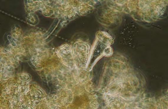 C: Vorticella sp.