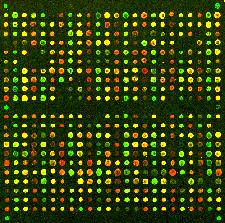 Análisis de perfiles de expresión de genes mediante microarreglos Microarreglo: pieza de vidrio o plástico sobre la cual se han pegado fragmentos de DNA (de hebra simple) en un arreglo microscópico.
