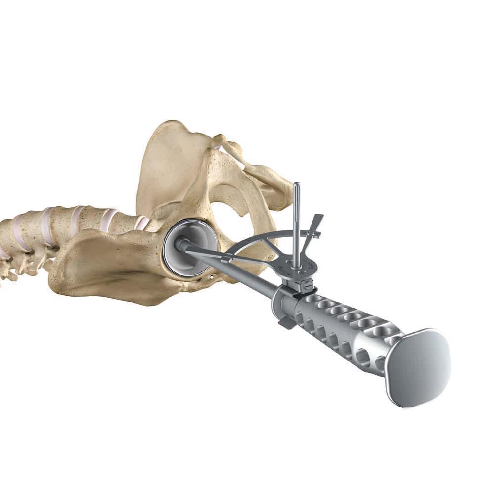 Para obtener la posición correcta del implante de cotilo se dispone de dispositivos guía para pacientes en decúbito