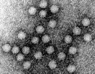 Parvovirus B19 Manifestaciones clínicas Generalmente asintomática Eritema infeccioso