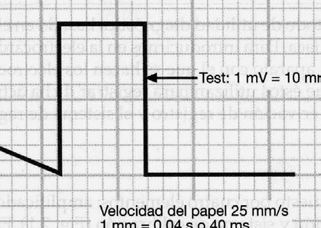 Velocidad del papel: 25 mm/seg: 1 cm de altura = 1 mv 1 mm = 0 04 seg 5 mm = 0