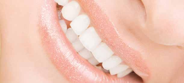 Módulos Reflex dimension Bleach Cada vez son más los pacientes que desean tener unos dientes perfectos, brillantes y blancos.