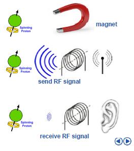 4. Principio de Medición por resonancia magnética (RM).