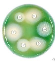 Otitis Externa Crónica - Tratamiento Cultivos y Antibiogramas Identificación de bacterias menos frecuentes Interpretación del antibiograma Sensibilidad está definida para