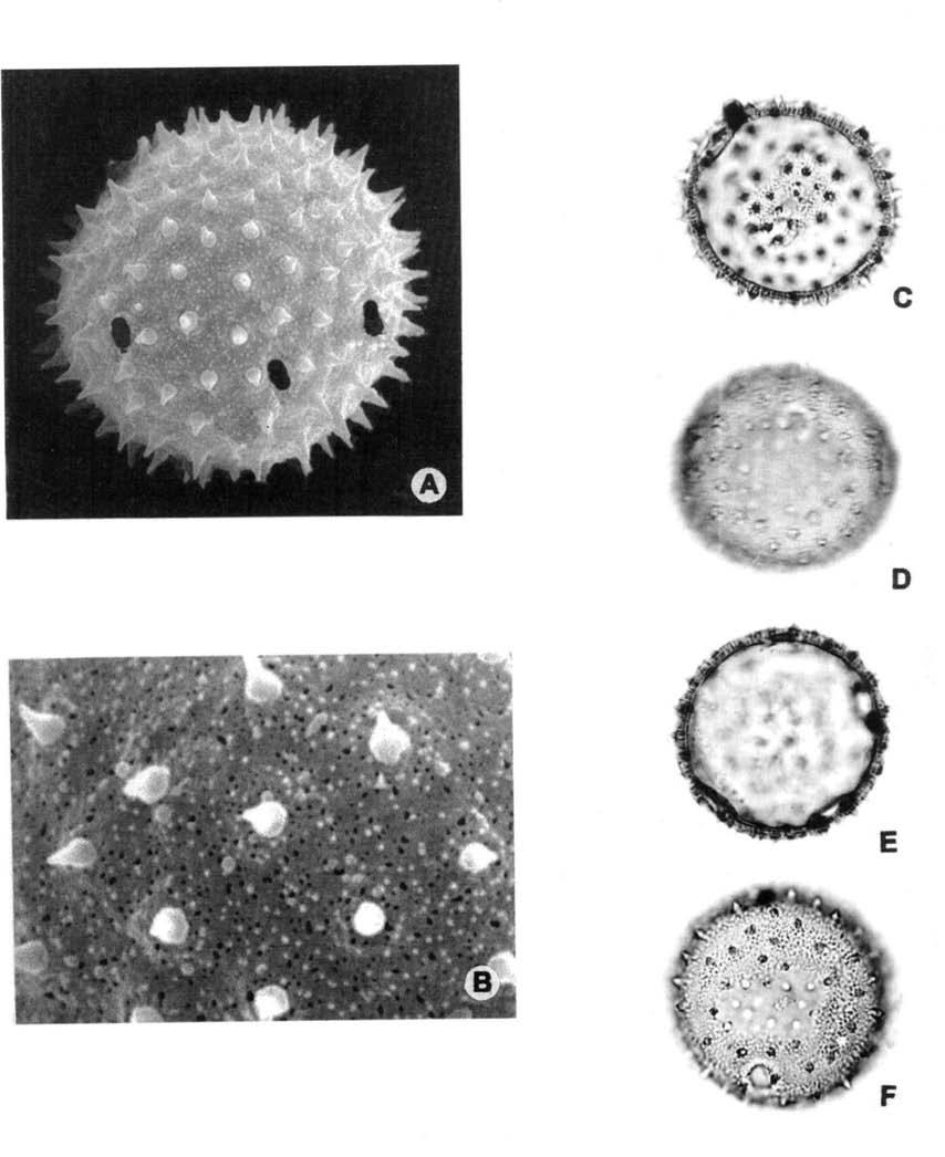 G.A. Cuadrado, Palinología de Modiola, y Tropidococcus, Malvaceae Fig. 2. Modiola caroliniana. MEB: A: vista ecuatorial, mostrando tres aperturas. B: detalle de escultura (5000x) (Pedersen 12974).