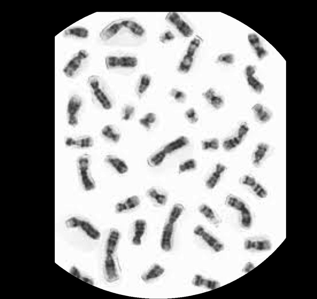 Cromosomas Varon