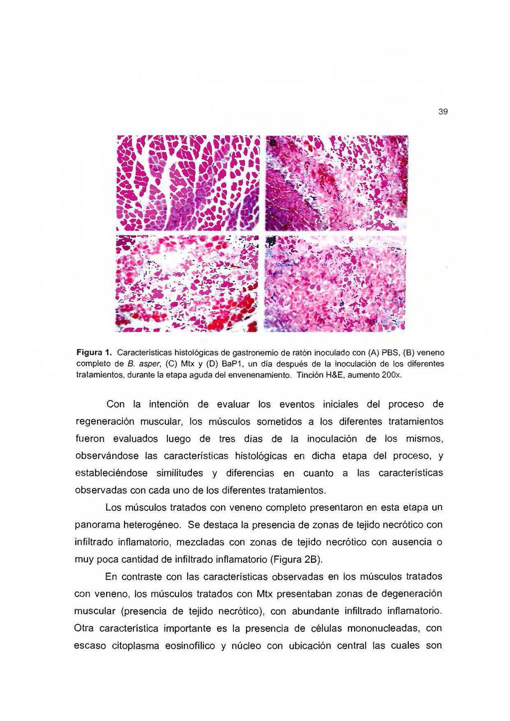 39 Figura 1. Características histológicas de gastronemio de ratón inoculado con (A) PBS. (B) veneno completo de B. asper, (C) Mtx y (D) BaP1.