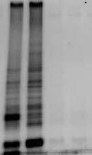 Determinación de la existencia de actividad telomerasa en VAL-10B La detección de la actividad telomerasa característica de células inmortales se ha realizado mediante una reacción de PCR utilizando