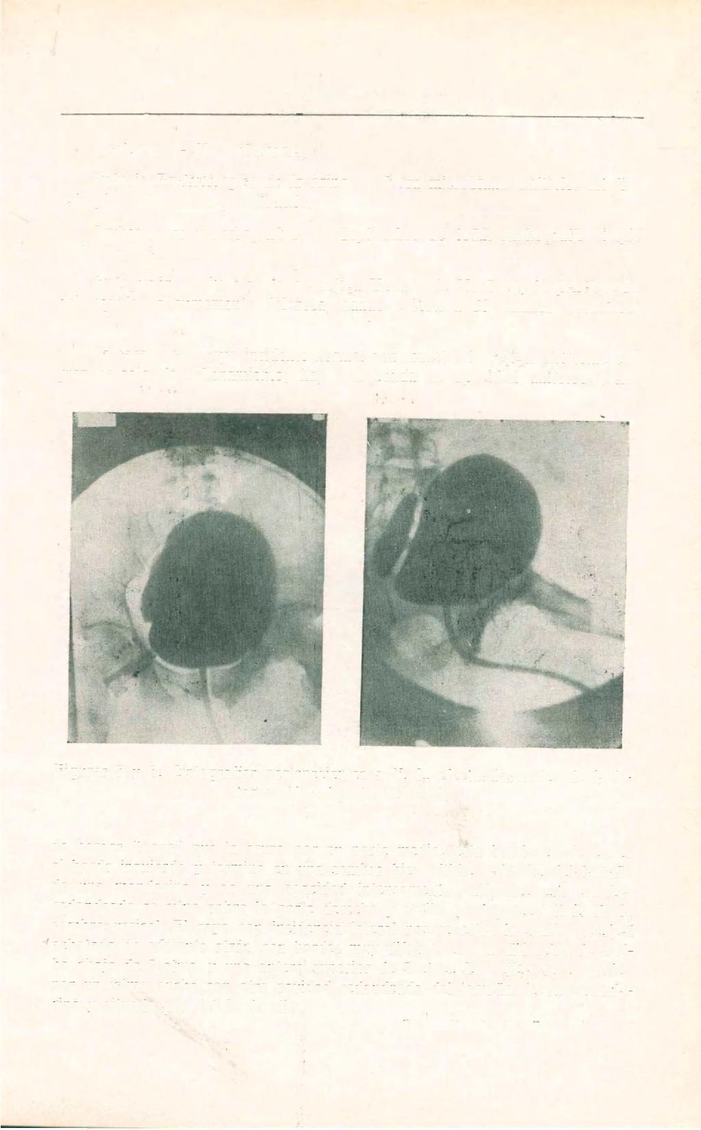 DE UROLOGIA 367 Uréteres. No dolorosos. Estudio Bacteriológico de la orina. Flora microbiana múltiple: estafilo, estrepto, enterococos y colibacilo. Radioscopias y radiografías. Septiembre de 1932.