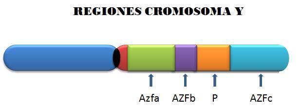 Microdeleciones de regiones AZF del cromosoma Y e infertilidad detergente, para luego adicionar 1.
