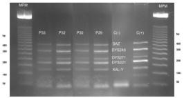Los genes analizados, mediante PCR multiplex, contenidos en cada STSs, por cada Multiplex máster mix A (DAZ, DYS240, DYS271, DYS221, KAL-Y, y control interno SMCX);