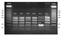 ml). Fuente: Protocolo Promega, sistema de detección deleciones cromosoma Y, versión 2, 2008 Figura Nº 2: Productos de Amplificación PCR Multiplex A, B, C, D, Y E