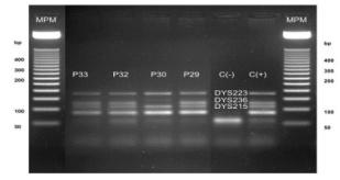 muestras de ADN muestran (M) marcador de peso molecular desde 500 a 50 pares de bases; (1) control positivo y (2) control negativo.