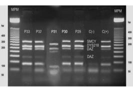de iniciadores C: DAZ (124 pb) y D DYS236 (125 pb) y su comparación con el producto de PCR multiplex.
