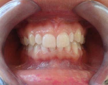 Salud Oral Exámen Clínico General: Paciente sin enfermedad