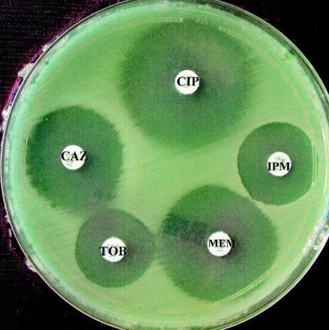 Comparación de resultados Prueba bioquímica Caso clínico Oxidasa + + Óxidofermentación (OF) + + Catalasa + ------ Laboratorio microbiología SIM ----- Movilidad (+) Producción H2S (-) Producción Indol
