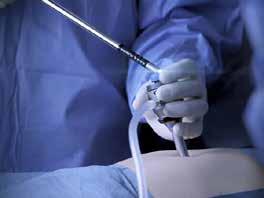 Posee todos los componentes necesarios para los procedimientos en Urología diagnóstica y quirúrgica.