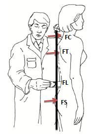 58 A partir de las cuatro flechas estableceremos el índice lordótico utilizando la siguiente fórmula, encontrando dos situaciones: La paciente presenta un eje adelantado, la flecha torácica es mayor