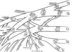 Revisión anatómica del plexo braquial Ramas colaterales supraclaviculares (Fig 8) Las ramas colaterales supraclaviculares de las raíces y los troncos son todas motoras, con la única excepción del