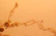 entre 430 a 520 µm de largo por 564 a 580 µm de ancho. En todos los soportes se apreció el desarrollo de tricomas desde la fase filamentosa hasta los gametofitos jóvenes.