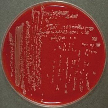 Pantoea Agglomerans, patógeno de plantas Bacteria útil