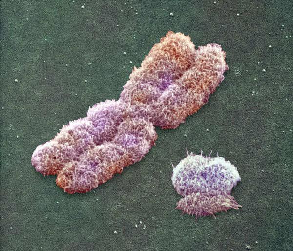 Cromosomas X e Y X a la izquierda