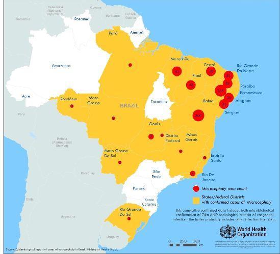 De los 6. 480 casos de microcefalia reportada en Brasil puedan estar asociados con una infección de virus de Zika, las investigaciones han concluido para 2.
