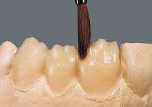estratificación. Para ello, se desbastan ligeramente los dientes por incisal y se incorporan mamelones.