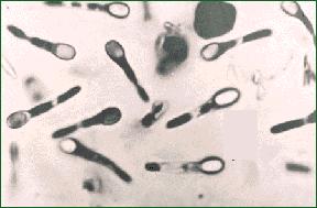 Clostridium Son bastones largos (hasta10 μm), anaerobios obligados, catalasa y oxidasa