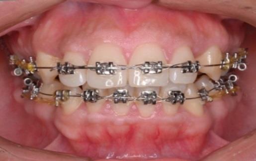 como, la estética, salud general de los dientes, y la queja principal del paciente.