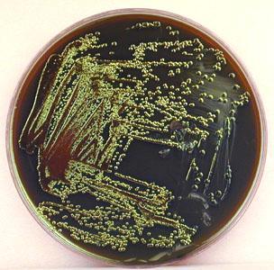 Detección de E.coli productoras de diarrea Siembra directa en EMB 24 h a 37 C.