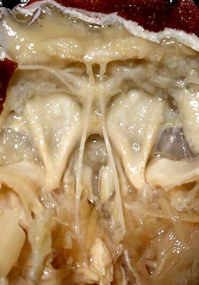 Cerebro Conectivos Nervios Anillo periesofágico Nervios segmentarios Ganglio torácico Detalles del sistema nervioso del crustáceo.