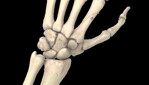 Figura 5 Nota: A diferencia de otros huesos, los metacarpianos y las falanges no contienen mucha esponjosa y están compuestos principalmente de hueso cortical más grueso.