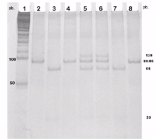 8 (3) 2004 Mutación F508 y fibrosis quística p. 16 Figura 1. Electroforesis en gel de poliacrilamida 8%, donde se detecta la mutación F508 en un grupo de pacientes con diagnóstico clínico de FQ.