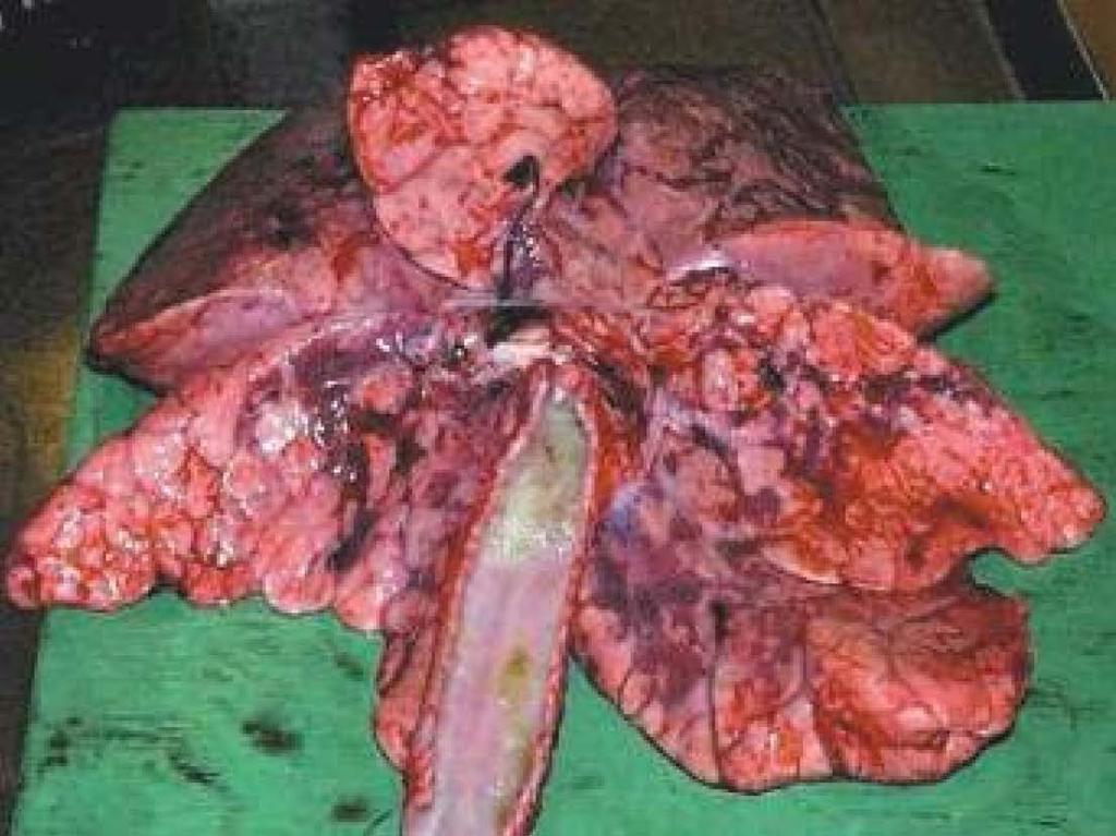 Figura 5.2: Aspecto post-mortem de los pulmones después de una exposición letal a fosgeno.