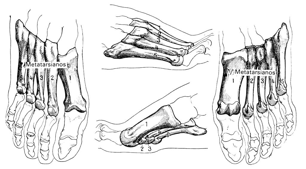 Metatarso (ossa metatarsis) Constituido por cinco huesos largos articulados con la segunda fila del tarso atrás y adelante con las primeras falanges. Presentan un cuerpo y dos extremos.