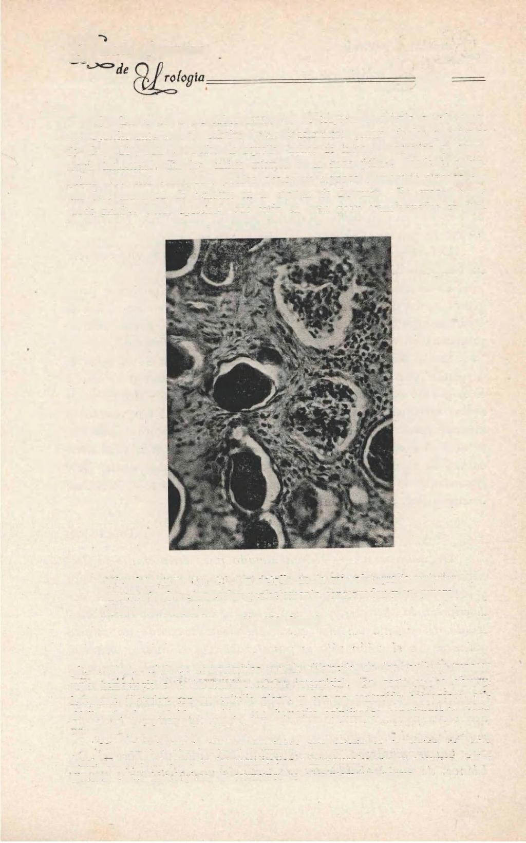 ^fyevista ^rg entina 481 Figura 4 Microfotografía No. 2: Un detalle de la microfotografía anterior mostrando dos rlomerulos perfectamente conservados y en general la falta de necrosis. (A: 900 diam.
