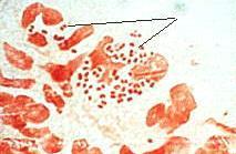 N. gonorrhoeae.